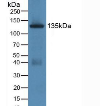 Jagged 1 (JAG1) Human Polyclonal Antibody