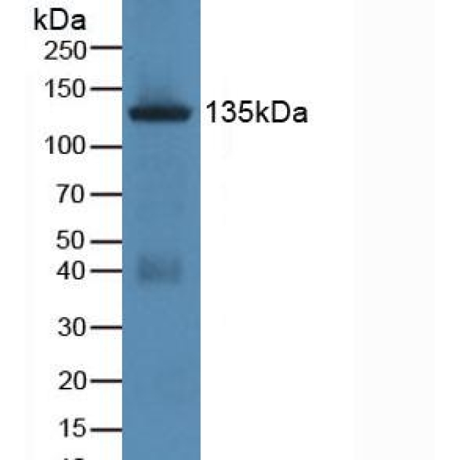 Jagged 1 (JAG1) Human Polyclonal Antibody