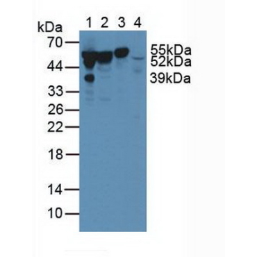Vitamin D Binding Protein (DBP) Human Polyclonal Antibody
