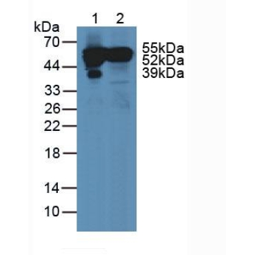 Vitamin D Binding Protein (DBP) Human Polyclonal Antibody