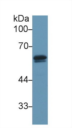 Vitamin D Binding Protein (DBP) Mouse Polyclonal Antibody