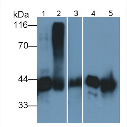 Vitamin D Binding Protein (DBP) Rat Polyclonal Antibody