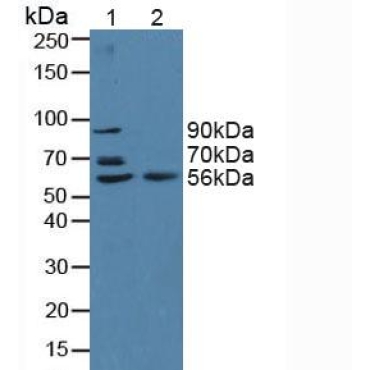 Beta Secretase 2 (BACE2) Human Polyclonal Antibody