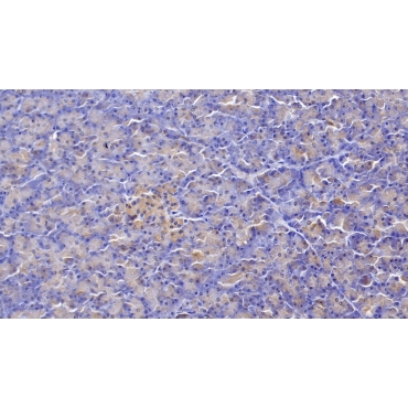 Frizzled Homolog 4 (FZD4) Human Polyclonal Antibody