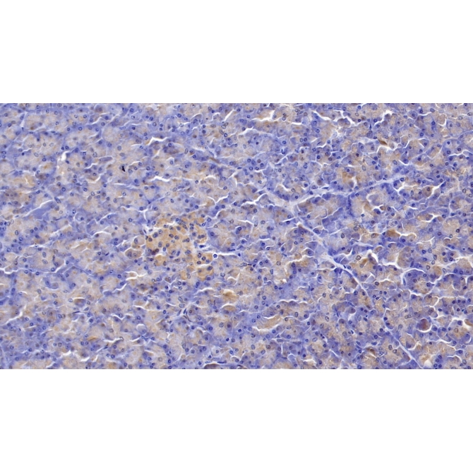 Frizzled Homolog 4 (FZD4) Human Polyclonal Antibody