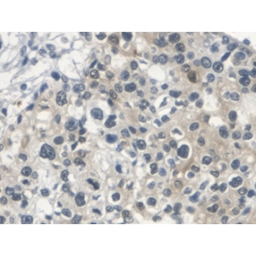 Squamous Cell Carcinoma Antigen 1/2 (SCCA1/SCCA2) Human Polyclonal Antibody