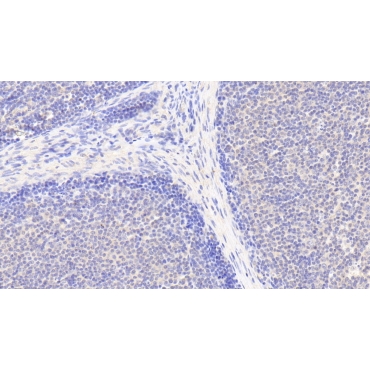 Interleukin 6 Receptor (IL6R) Human Polyclonal Antibody