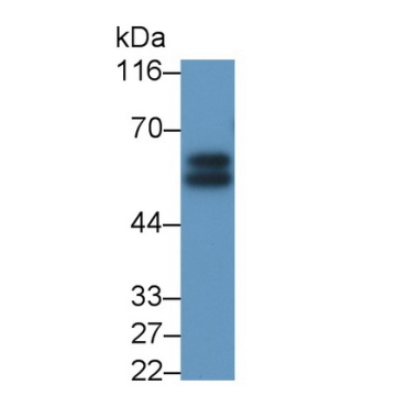 Interleukin 6 Receptor (IL6R) Mouse Polyclonal Antibody
