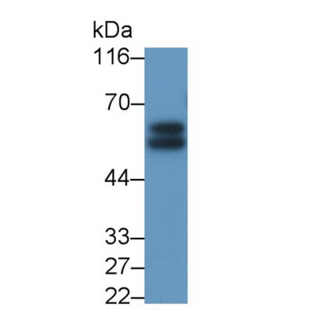 Interleukin 6 Receptor (IL6R) Mouse Polyclonal Antibody