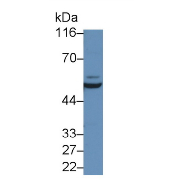 Interleukin 6 Receptor (IL6R) Mouse Polyclonal Antibody