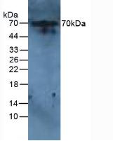Interleukin 6 Receptor (IL6R) Rat Polyclonal Antibody