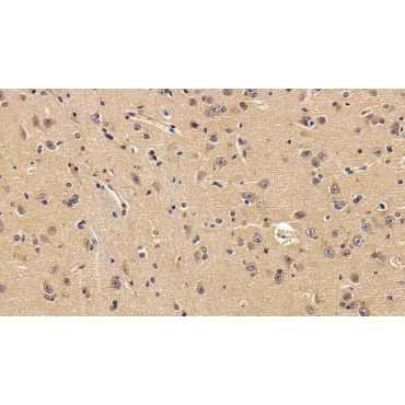 Versican (VCAN) Human Polyclonal Antibody