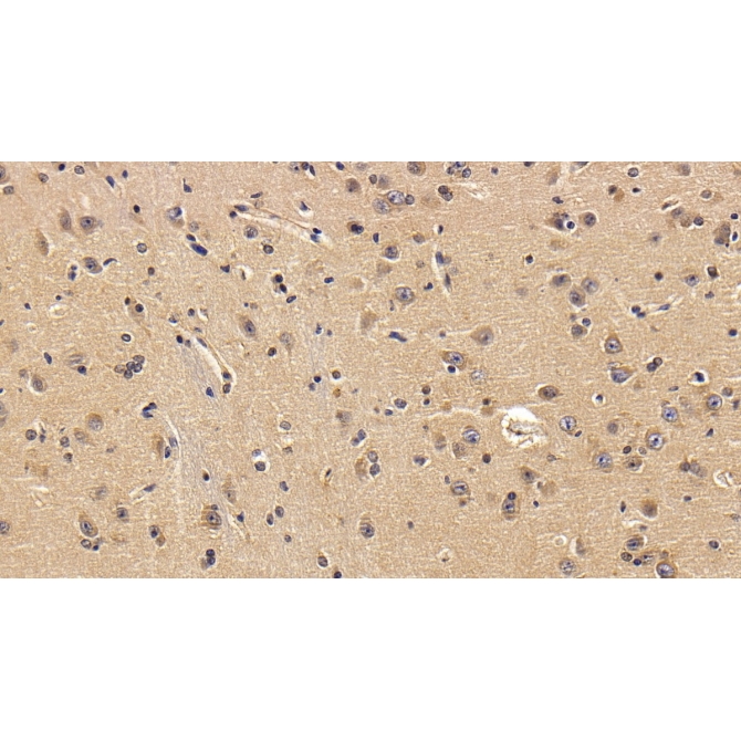 Versican (VCAN) Human Polyclonal Antibody