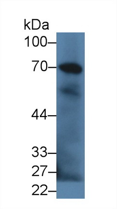 Complement Component 9 (C9) Rabbit Polyclonal Antibody
