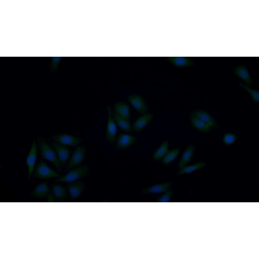 Nuclear Factor Kappa B (NFkB) Human Polyclonal Antibody