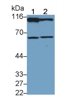 Nuclear Factor Kappa B (NFkB) Human Polyclonal Antibody