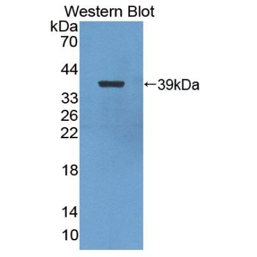 Nuclear Factor Kappa B2 (NFkB2) Chicken (Gallus) Polyclonal Antibody