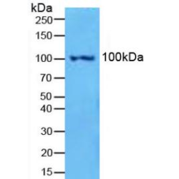 Nuclear Factor Kappa B2 (NFkB2) Human Polyclonal Antibody