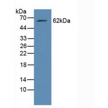 V-Rel Reticuloendotheliosis Viral Oncogene Homolog B (RELB) Human Polyclonal Antibody