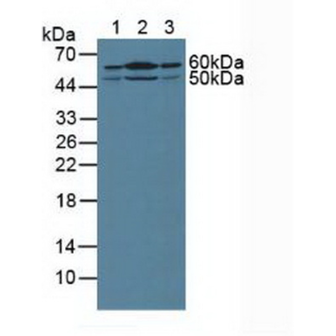 Hedgehog Homolog, Sonic (SHH) Human Polyclonal Antibody