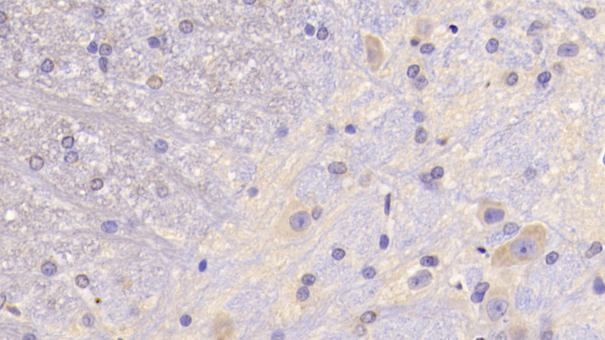 Hedgehog Homolog, Sonic (SHH) Rat Polyclonal Antibody