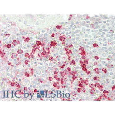 Complement Factor D (CFD) Human Polyclonal Antibody