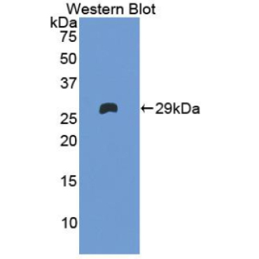 Coagulation Factor XI (F11) Human Polyclonal Antibody