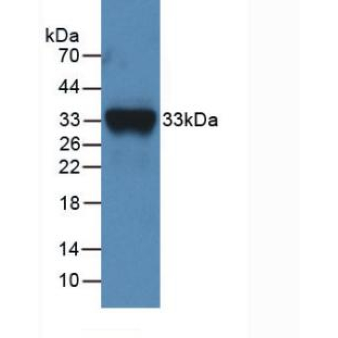 Coagulation Factor XI (F11) Mouse Polyclonal Antibody