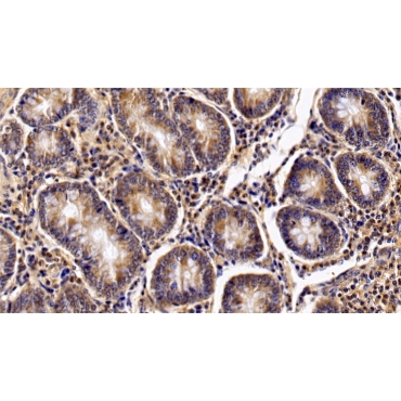 Interleukin 2 Receptor Alpha (IL2Ra) Bovine (Cattle) Polyclonal Antibody