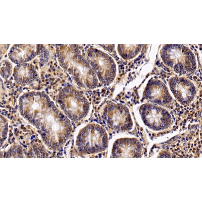 Interleukin 2 Receptor Alpha (IL2Ra) Bovine (Cattle) Polyclonal Antibody