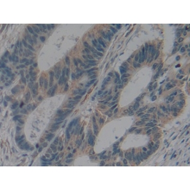 Interleukin 2 Receptor Alpha (IL2Ra) Human Polyclonal Antibody