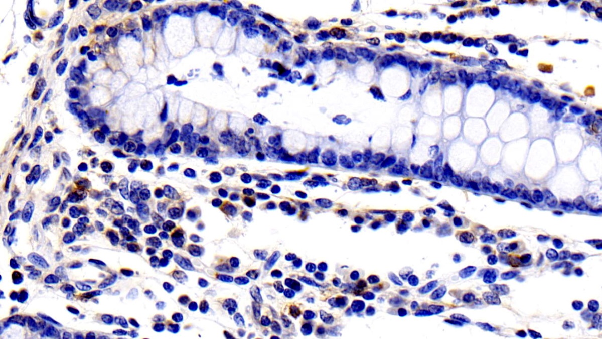 Interleukin 2 Receptor Alpha (IL2Ra) Pig Polyclonal Antibody