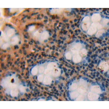 Small Breast Epithelial Mucin (SBEM) Human Polyclonal Antibody