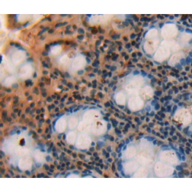 Small Breast Epithelial Mucin (SBEM) Human Polyclonal Antibody