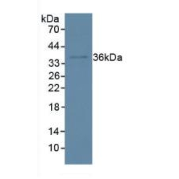 Inhibitory Subunit Of NF Kappa B Alpha (IkBa) Human Polyclonal Antibody