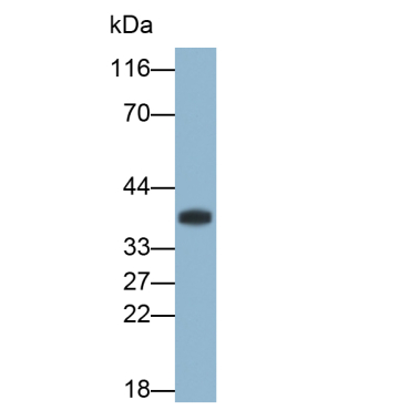 Inhibitory Subunit Of NF Kappa B Alpha (IkBa) Mouse Polyclonal Antibody