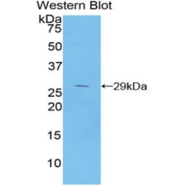 Inhibitory Subunit Of NF Kappa B Beta (IkBb) Mouse Polyclonal Antibody