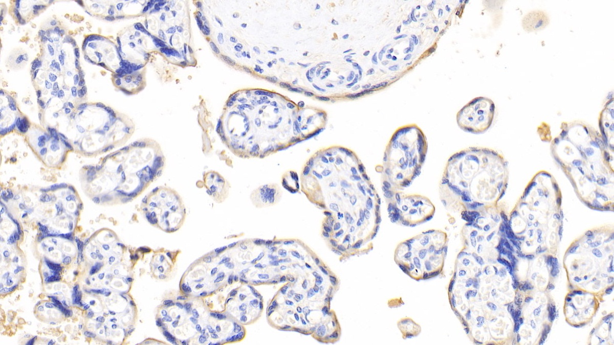 Vascular Endothelial Growth Factor 121 (VEGF121) Human Polyclonal Antibody