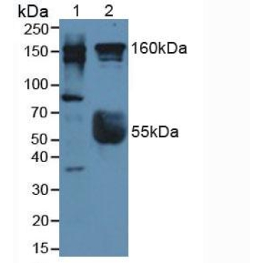 Rho Associated Coiled Coil Containing Protein Kinase 2 (Rock2) Human Polyclonal Antibody