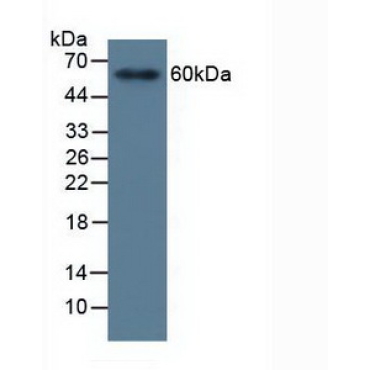 Matrix Metalloproteinase 19 (MMP19) Human Polyclonal Antibody