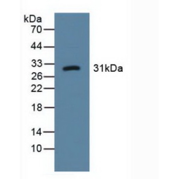 Lectin Like Oxidized Low Density Lipoprotein Receptor 1 (LOX1) Human Polyclonal Antibody