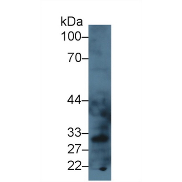 Lectin Like Oxidized Low Density Lipoprotein Receptor 1 (LOX1) Mouse Polyclonal Antibody