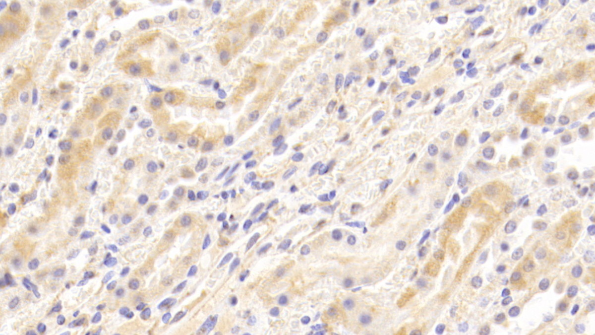 Lectin Like Oxidized Low Density Lipoprotein Receptor 1 (LOX1) Rabbit Polyclonal Antibody