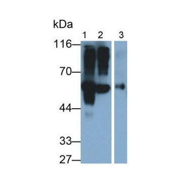 Fetuin B (FETUB) Mouse Polyclonal Antibody