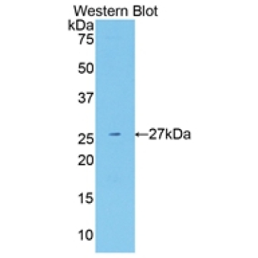 Neuregulin 1 (NRG1) Human Polyclonal Antibody