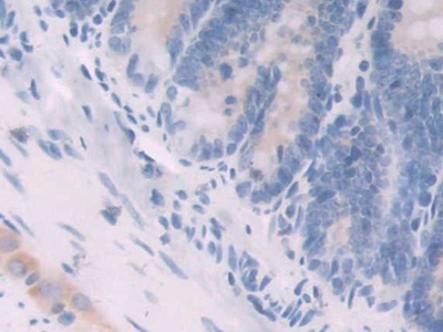 Neuregulin 1 (NRG1) Rat Polyclonal Antibody