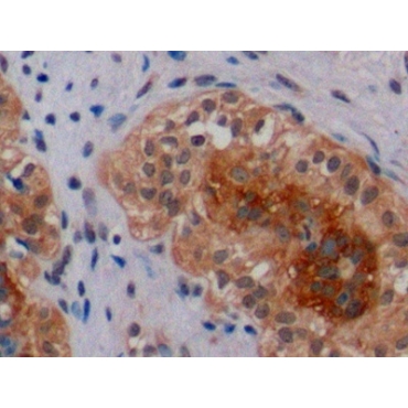 Receptor Tyrosine Protein Kinase erbB-2 (ErbB2) Human Polyclonal Antibody