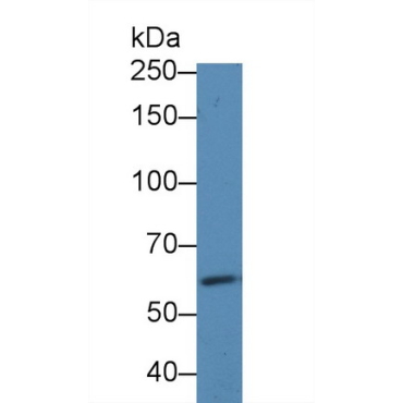 Receptor Tyrosine Protein Kinase erbB-2 (ErbB2) Human Polyclonal Antibody