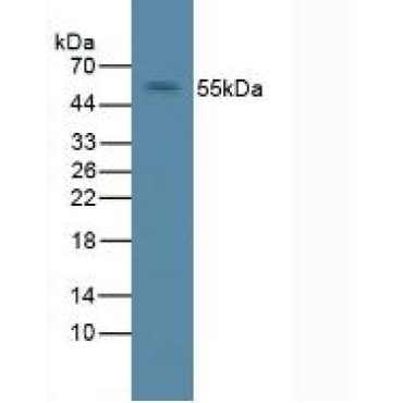 Receptor Tyrosine Protein Kinase erbB-2 (ErbB2) Mouse Polyclonal Antibody