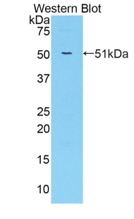 Receptor Tyrosine Protein Kinase erbB-2 (ErbB2) Rat Polyclonal Antibody
